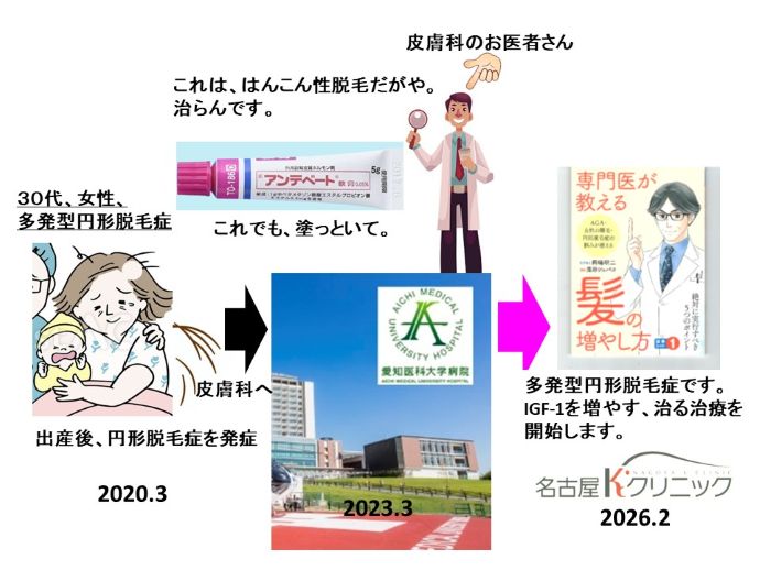 円形脱毛症　病院